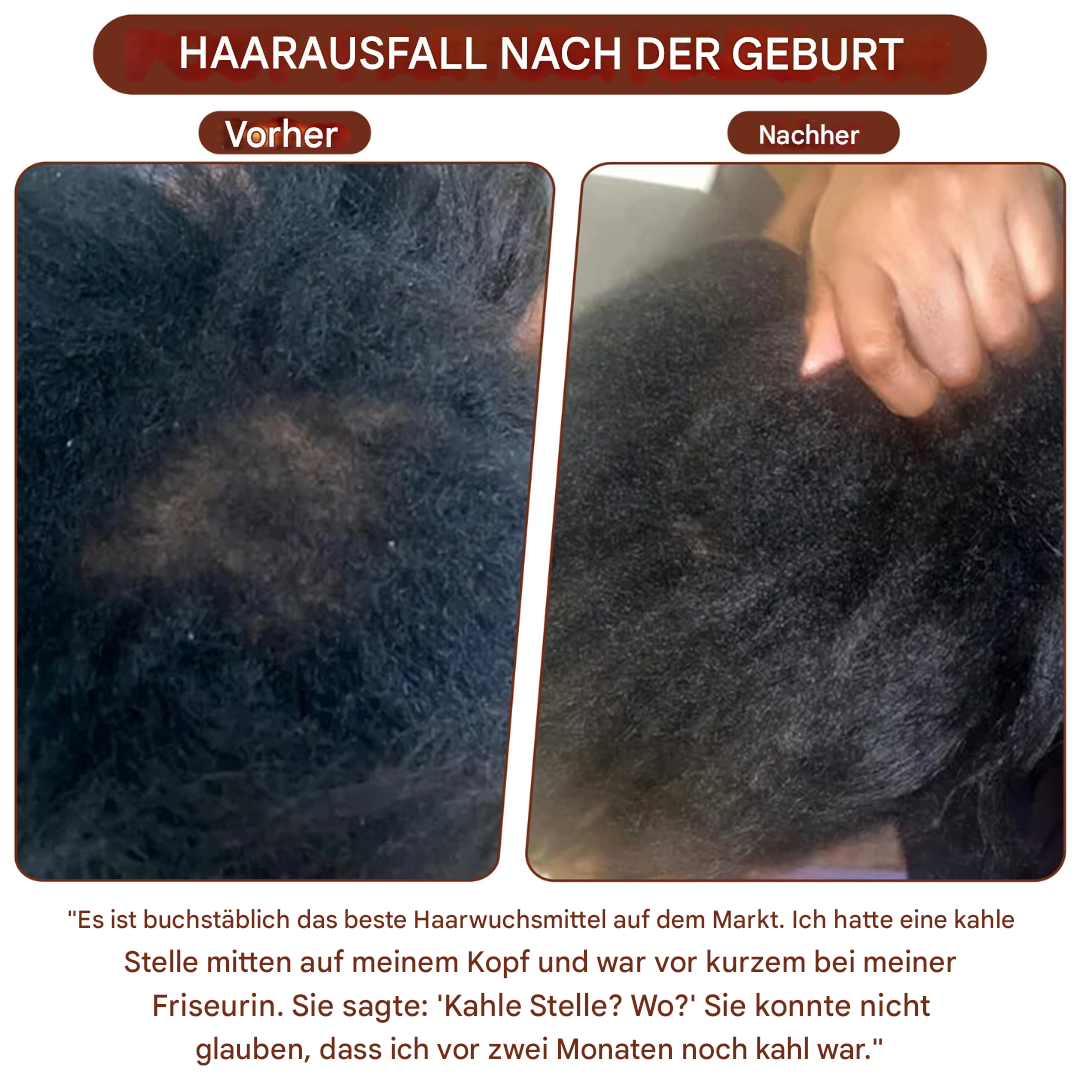 Hookvue™|Batana Haar Groei Olie