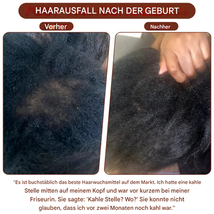 Hookvue™|Batana Haar Groei Olie