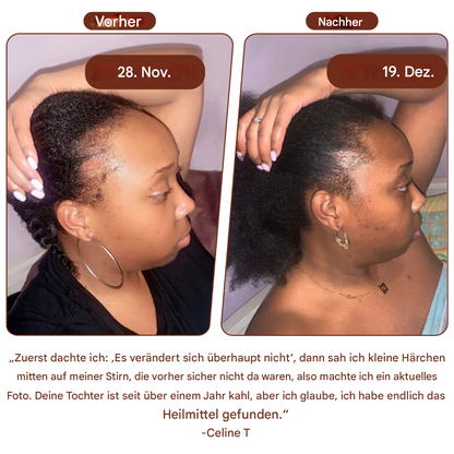 Hookvue™|Batana Haar Groei Olie